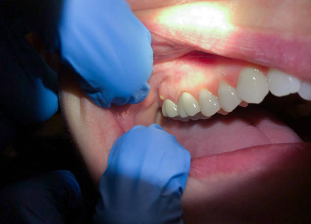 Best Walk-In Emergency Dentist in Austintown, OH